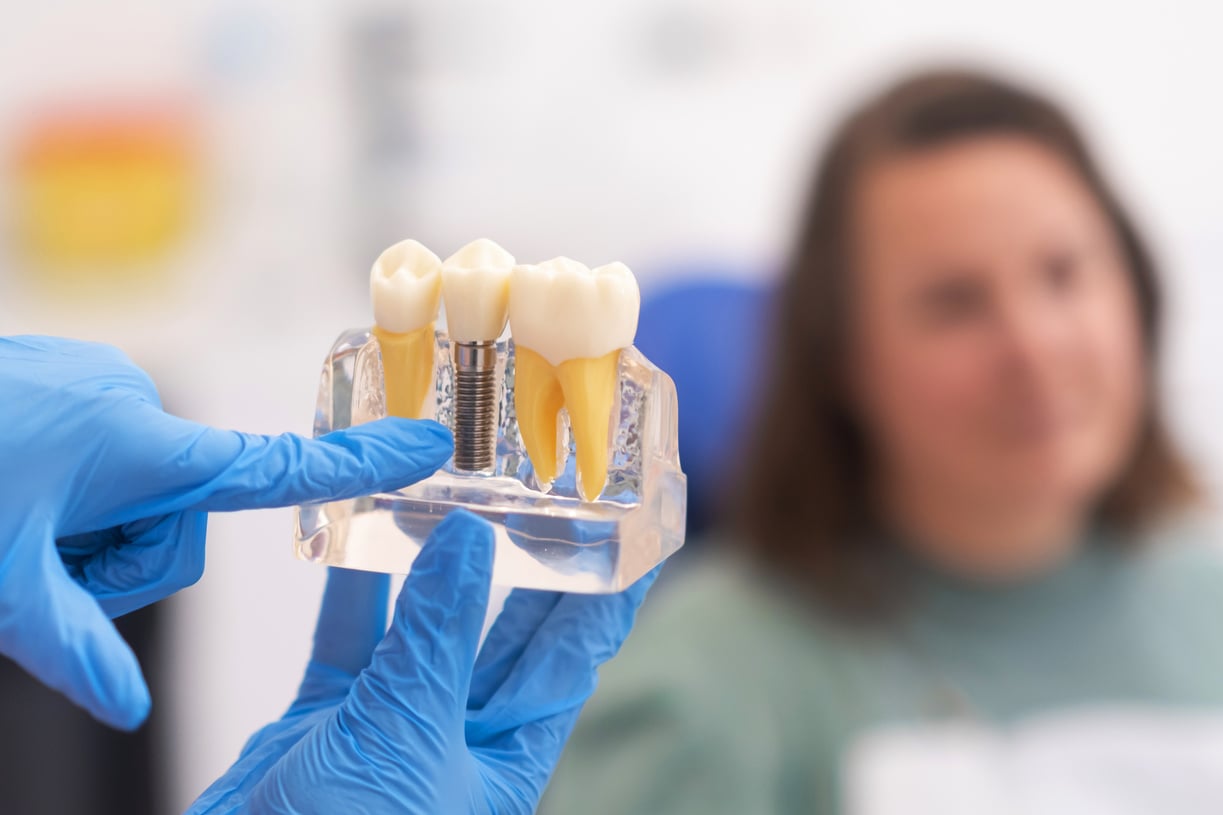 dental implants, dentist discussing a treatment plan with patient holds a dental implant model